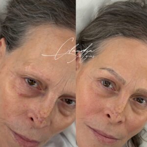 Nanoblading Profesional